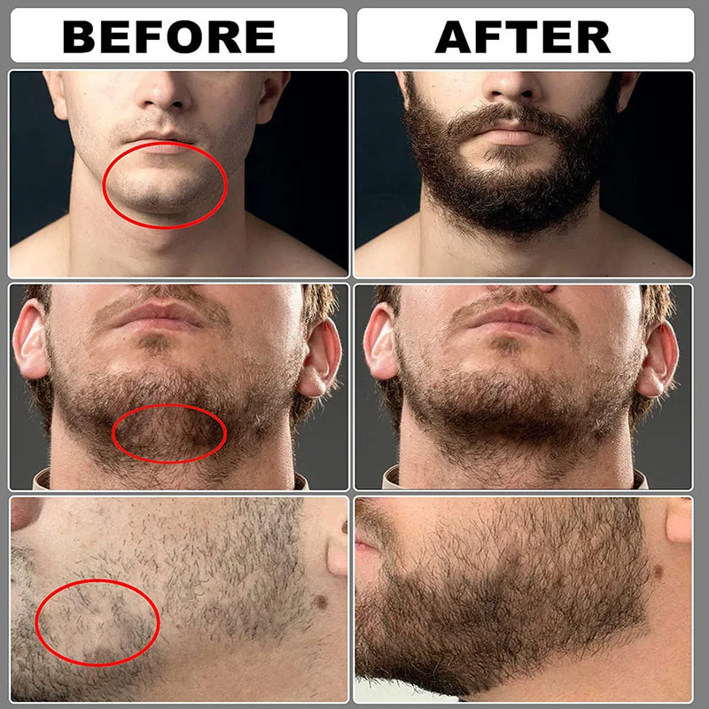 Kit de Crescimento De Barba para Homens